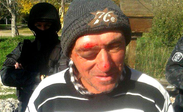 Ojeda tras la agresión
