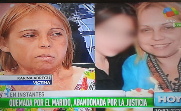 Karina en canal América denunciando el intento de femicidio
