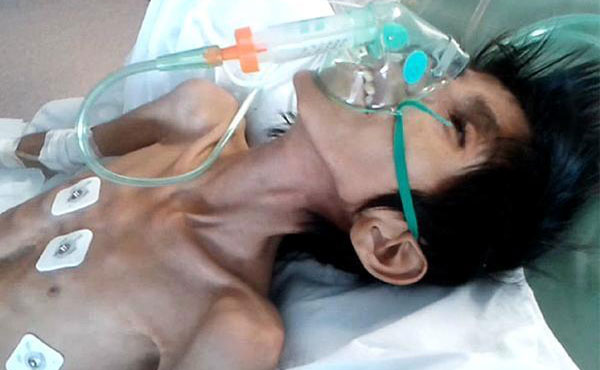 El país se volvió a conmover con otra muerte de un niño Qom, por desnutrición, en el Chaco.