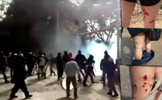 El día 14 de julio, a pocas horas de haber iniciado un paro por tiempo indeterminado, los trabajadores del Ingenio Ledesma fueron brutalmente reprimidos por la Guardia de Infantería de Jujuy, comandada por el gobernador radical Gerardo Morales. El saldo fue de 80 heridos.