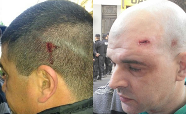 Varios trabajadores sufrieron heridas y contusiones, debiendo ser atendidos en hospitales.