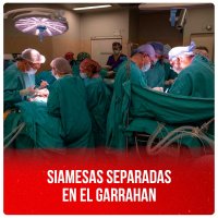 Siamesas separadas en el Garrahan