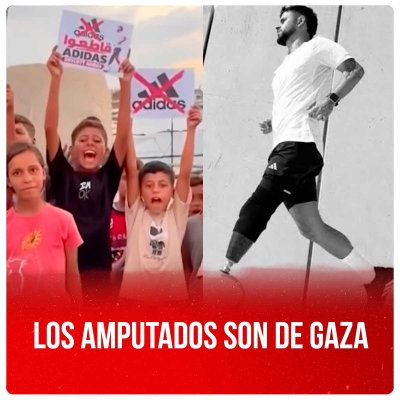 Los amputados son de Gaza