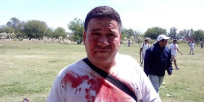 Cresta Roja: La represión de Berni y Kicillof