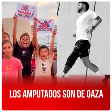 Los amputados son de Gaza