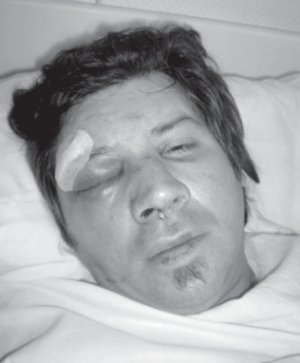 Luis Bentez agredido por integrantes de la Lista Violeta (MST). Bentez fue despedido en la privatizacin menemista y hoy reclama por la reestatizacin junto a sus compaeros de la Bord